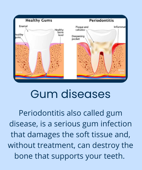 Dental care (2)