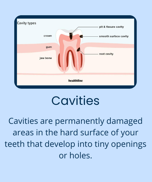 Dental care