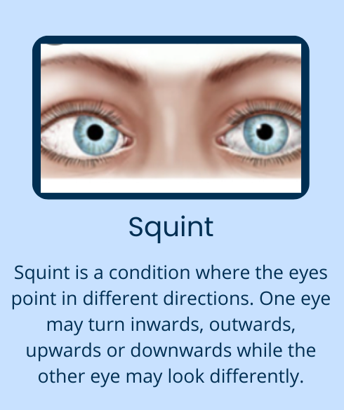 Homepage eye services